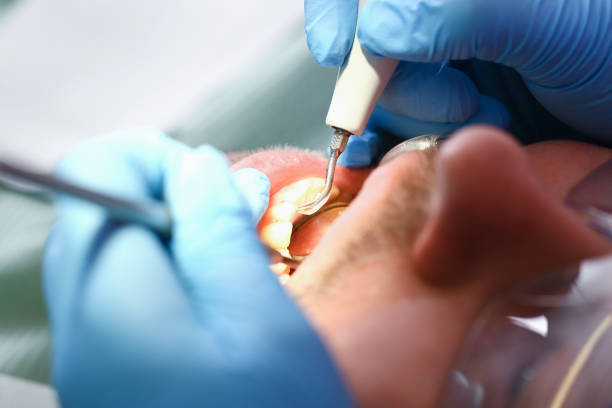 Best Emergency Care for Gum Disease in Auburn, CA