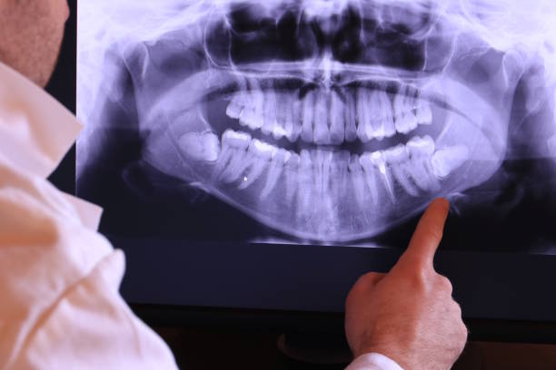 Best Broken or Chipped Tooth Repair in Auburn, CA